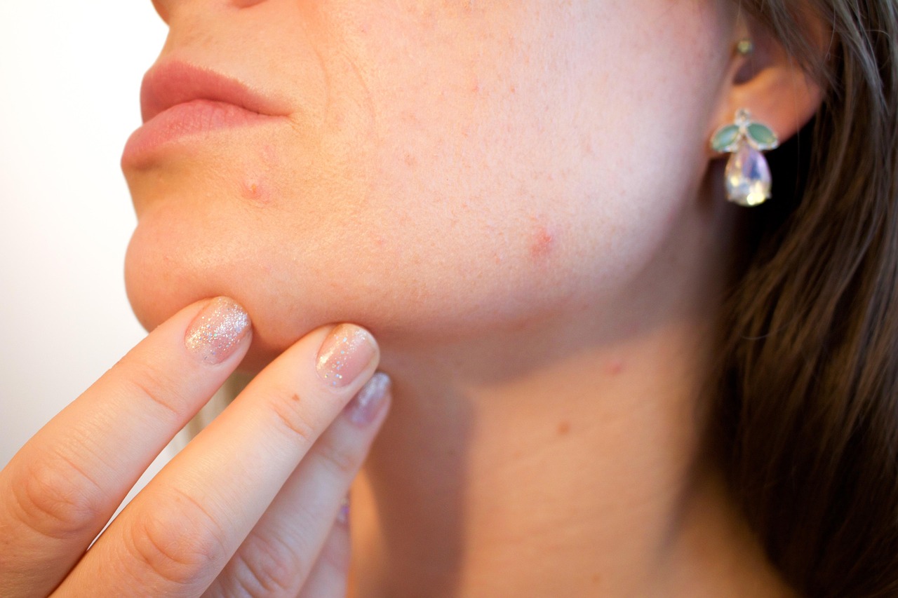 毛穴の悩みを美容皮膚科でカウンセリングする際に確認することは？