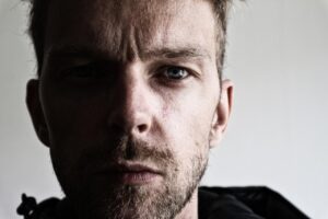 40代の鼻の黒ずみを改善するための効果的な方法は？
